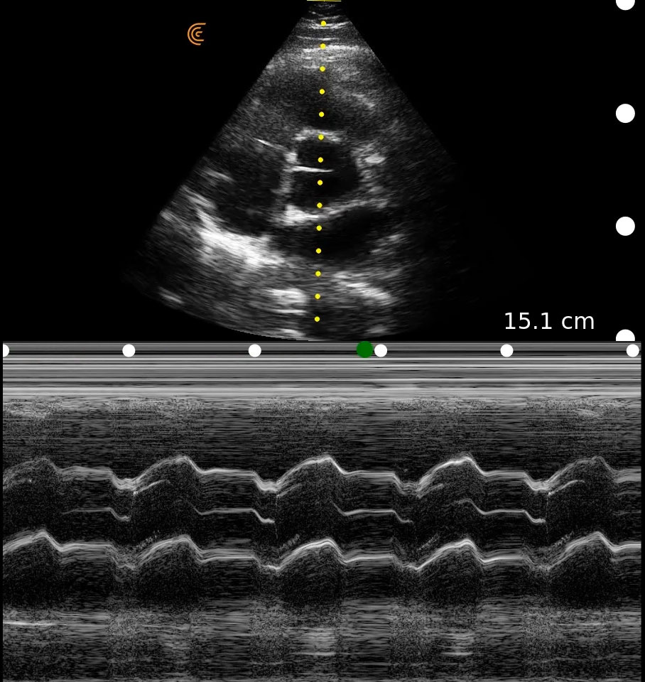 Cardiac MedEd CC AV Mmode PA HD Tablet.jpg